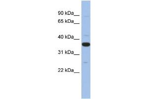 WB Suggested Anti-MYD88 Antibody Titration: 0. (MYD88 Antikörper  (Middle Region))