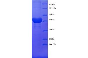 SDS-PAGE (SDS) image for Histone H2B Type 1-C/E/F/G/I (LOC100407767) (AA 2-125) protein (GST tag) (ABIN5712177) (Histone H2B Type 1-C/E/F/G/I (LOC100407767) (AA 2-125) protein (GST tag))