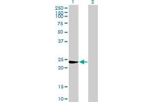 Western Blot analysis of GSTM3 expression in transfected 293T cell line by GSTM3 MaxPab polyclonal antibody. (GSTM3 Antikörper  (AA 1-225))