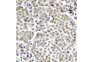 Immunohistochemistry (IHC) image for anti-Nuclear Factor-kB p65 (NFkBP65) (pSer529) antibody (ABIN1870581) (NF-kB p65 Antikörper  (pSer529))