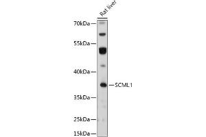 Western blot analysis of extracts of Rat liver, using SCML1 antibody (ABIN7270268) at 1:1000 dilution. (SCML1 Antikörper  (AA 50-200))