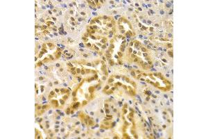 Immunohistochemistry (IHC) image for anti-Mitogen-Activated Protein Kinase 7 (MAPK7) (AA 1-310) antibody (ABIN3022945)