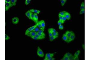 Immunofluorescence staining of HepG2 cells with ABIN7168797 at 1:100, counter-stained with DAPI. (SEMA4B Antikörper  (AA 163-253))