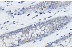 Immunohistochemistry of paraffin-embedded Human colon using MonoMethyl-Histone H4-K20 Polyclonal Antibody at dilution of 1:200 (40x lens). (Histone H4 Antikörper  (meLys20))