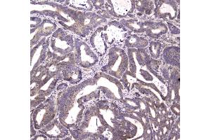 IHC analysis of HTRA1 using anti-HTRA1 antibody . (HTRA1 Antikörper)
