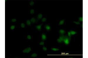 Immunofluorescence of monoclonal antibody to DPH1 on HeLa cell. (DPH1 Antikörper  (AA 216-324))