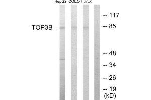 Western Blotting (WB) image for anti-Topoisomerase (DNA) III beta (TOP3B) (N-Term) antibody (ABIN1849086) (TOP3B Antikörper  (N-Term))