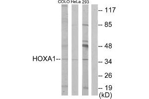Western blot analysis of extracts from COLO cells, HeLa/ cells and 293 cells, using HOXA1 antibody. (HOXA1 Antikörper  (Internal Region))