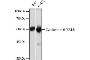 Western blot analysis of extracts of various cell lines, using Cytokeratin 6 (KRT6) (KRT6) Rabbit mAb (ABIN7268104) at 1:1000 dilution. (Keratin 6C Antikörper)