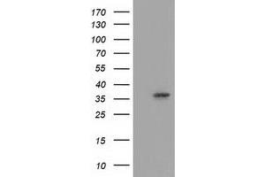 HEK293T cells were transfected with the pCMV6-ENTRY control (Left lane) or pCMV6-ENTRY ANXA3 (Right lane) cDNA for 48 hrs and lysed. (Annexin A3 Antikörper)