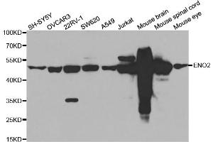 Western blot analysis of extracts of various cell lines, using ENO2 antibody (ABIN5971596) at 1/500 dilution. (ENO2/NSE Antikörper)