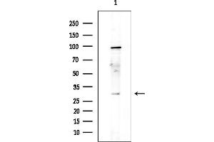 Western blot analysis of lysates from EC304 cells(heat-shock treatment), using B Antibody at 1/1000 dilution.