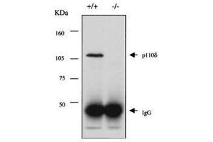 Anti-PI3K p110d Antibody - Western Blot Immunoprecipitation and western blot using ROCKLAND Immunochemical's Rabbit-anti-PI3K p110d antibody. (PIK3CD Antikörper  (C-Term))