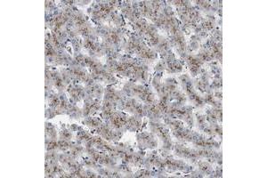 Immunohistochemical staining of human liver with NHLRC3 polyclonal antibody  shows strong cytoplasmic positivity with granular pattern in hepatocytes at 1:10-1:20 dilution. (NHLRC3 Antikörper)