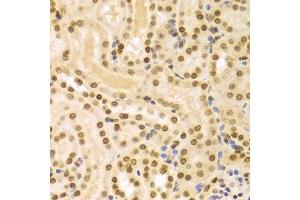 Immunohistochemistry of paraffin-embedded Mouse kidney using DKC1 antibody at dilution of 1:100 (x400 lens). (DKC1 Antikörper  (AA 245-514))