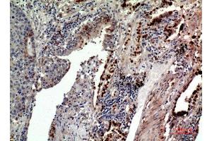 Immunohistochemistry (IHC) analysis of paraffin-embedded Human Lung, antibody was diluted at 1:100. (CD163L1 Antikörper  (Internal Region))