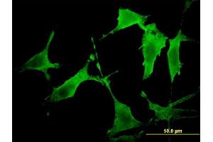 Immunofluorescence of monoclonal antibody to PAK3 on NIH/3T3 cell. (PAK3 Antikörper  (AA 1-90))