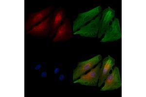 ABIN6263887 and ABIN6278613 staining  cells by IF/ICC.