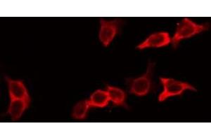 ABIN6266713 staining HeLa by IF/ICC. (Ephrin A2 Antikörper  (N-Term))