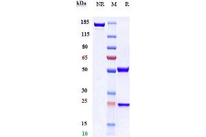 Anti-ACVR2A Reference Antibody (Ab-14E1) on SDS-PAGE under reducing (R) condition.