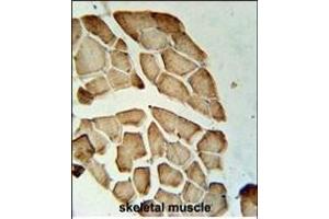 LDHD Antibody (N-term) (ABIN651920 and ABIN2840455) immunohistochemistry analysis in formalin fixed and paraffin embedded human skeletal muscle followed by peroxidase conjugation of the secondary antibody and DAB staining. (LDHD Antikörper  (N-Term))