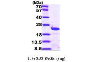SDS-PAGE (SDS) image for Centrin, EF-Hand Protein, 3 (CETN3) (AA 1-167) protein (His tag) (ABIN667815) (CETN3 Protein (AA 1-167) (His tag))