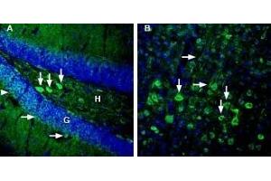Expression of GPR83 in mouse hippocampus and cortex - Immunohistochemical staining of perfusion-fixed frozen mouse brain sections with Anti-GPR83 (extracellular) Antibody (ABIN7043174, ABIN7044445 and ABIN7044446), (1:3000), followed by goat anti-rabbit-AlexaFluor-488. (GPR83 Antikörper  (Extracellular))
