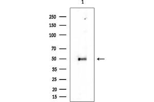 anti-Transmembrane Protein 123 (TMEM123) antibody
