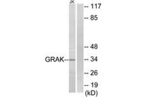 Western blot analysis of extracts from Jurkat cells, using GRAK Antibody. (GZMK Antikörper  (AA 61-110))