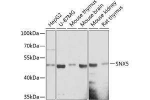 Western blot analysis of extracts of various cell lines, using SNX5 antibody (ABIN6128730, ABIN6148253, ABIN6148254 and ABIN6217052) at 1:3000 dilution. (SNX5 Antikörper  (AA 145-404))