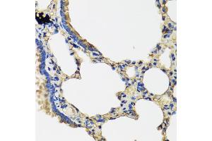 Immunohistochemistry of paraffin-embedded rat lung using IL36G antibody (ABIN5974550) at dilution of 1/100 (40x lens). (IL1F9 Antikörper)