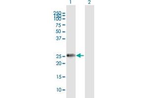 Western Blot analysis of MMP7 expression in transfected 293T cell line by MMP7 MaxPab polyclonal antibody. (MMP7 Antikörper  (AA 1-267))