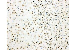 IHC-F testing of mouse brain tissue (HDAC3 Antikörper  (AA 411-428))