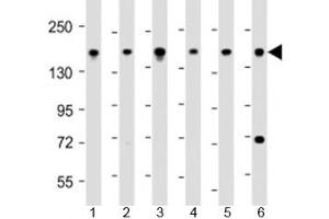Western blot testing of human 1) 293T/17, 2) DU-145, 3) LNCaP, 4) Raji, 5) U-2OS and 6) HeLa cell lysate with PDS5B antibody at 1:2000. (PDS5B Antikörper  (AA 1197-1228))
