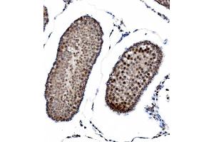 IHC analysis of PRDM14 using anti-PRDM14 antibody (ABIN7603152). (PRDM14 Antikörper  (N-Term))
