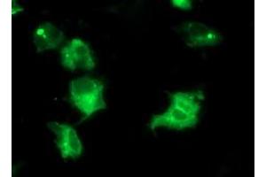 Immunofluorescence (IF) image for anti-Interferon Regulatory Factor 6 (IRF6) antibody (ABIN1498903) (IRF6 Antikörper)