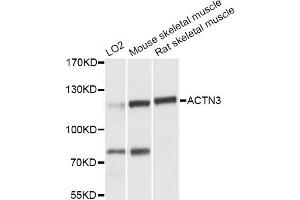 Western blot analysis of extracts of various cell lines, using ACTN3 antibody (ABIN6290057) at 1:3000 dilution. (ACTN3 Antikörper)