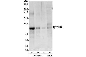 anti-Tousled-Like Kinase 2 (TLK2) (AA 722-772) antibody