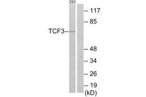 Western blot analysis of extracts from 293 cells, using TCF3 antibody. (TCF3 Antikörper  (C-Term))
