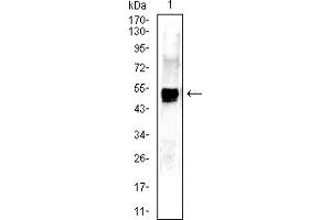 Western Blotting (WB) image for anti-Keratin 13 (KRT13) (AA 104-458) antibody (ABIN7193705)