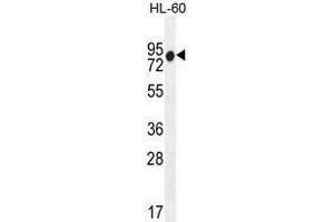 ZNF665 Antibody (N-term) western blot analysis in HL-60 cell line lysates (35 µg/lane). (ZNF665 Antikörper  (N-Term))