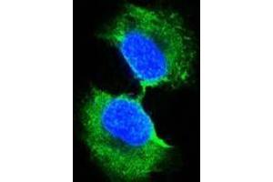 Confocal immunofluorescence analysis of PC-3 cells using GSTP1 antibody (green). (GSTP1 Antikörper)