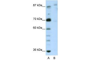 GLIS3 antibody (20R-1239) used at 0. (GLIS3 Antikörper  (N-Term))