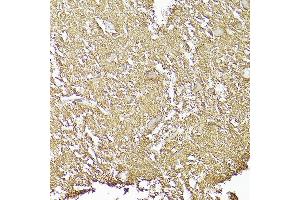 Immunohistochemistry of paraffin-embedded human brain using CD90/Thy1 Rabbit mAb (ABIN6129735, ABIN6148554, ABIN6148555 and ABIN7101405) at dilution of 1:100 (40x lens). (CD90 Antikörper)