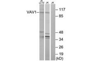Western blot analysis of extracts from Jurkat cells, using VAV1 (Ab-174) Antibody. (VAV1 Antikörper  (AA 141-190))