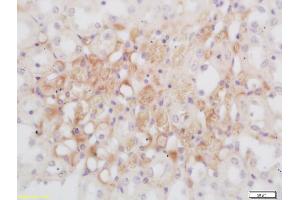 Formalin-fixed and paraffin embedded rat kidney labeled with Rabbit Anti GNMT Polyclonal Antibody, Unconjugated (ABIN739680) at 1:200 followed by conjugation to the secondary antibody and DAB staining (GNMT Antikörper  (AA 51-150))