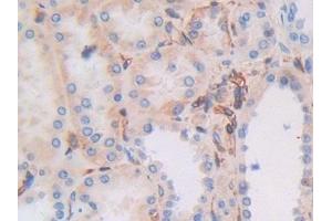 Detection of MHCC in Human Kidney Tissue using Polyclonal Antibody to Major Histocompatibility Complex Class I C (MHCC) (MHCC (AA 48-305) Antikörper)