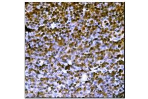IHC analysis of PML Protein/Pml using anti-PML Protein/Pml antibody (ABIN7599678). (PML Antikörper  (AA 107-857))