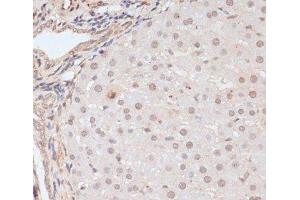 Immunohistochemistry of paraffin-embedded Rat liver using Phospho-BRCA1(S1423) Polyclonal Antibody at dilution of 1:100 (40x lens). (BRCA1 Antikörper  (pSer1423))
