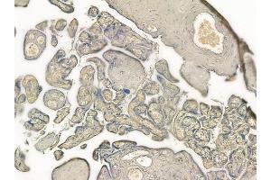 ABIN6257334 and ABIN6274315 at 1/100 staining human normal placenta tissue by IHC-P. (MVK Antikörper  (Internal Region))